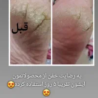 تونیک نانو وگان حاوی کلوئیدنقره