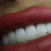 نیازمند دندانپزشک با تجربه