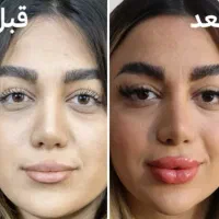 لباس جدید|لباس|زنجان, |دیوار