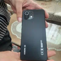 xiaomi note 11 ne 5g