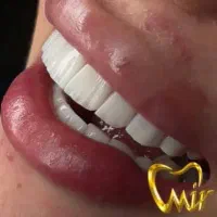 دستیار دندانپزشک