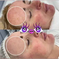 آموزش فشیال با پلاژن/از صفر تا درآمد