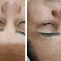 پاکسازی پوست|خدمات آرایشگری و زیبایی|مشهد, گلبرگ|دیوار