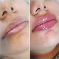مرکز لیزر و زیبایی الماس.اندولیفت.بوتاکس.ژل لاغری|خدمات آرایشگری و زیبایی|اصفهان, شاهزید|دیوار