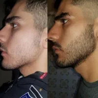 کمتر از ۵۰ روز ریش پر پشت داشته باش