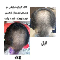 جشنواره کلینیک زیبایی دکتر فهیمه اربابی|خدمات آرایشگری و زیبایی|زابل, |دیوار