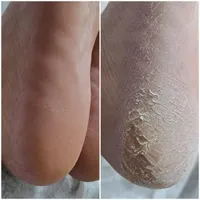 پدیکور و کف سابی پا|خدمات آرایشگری و زیبایی|اصفهان, خرم|دیوار