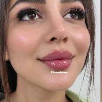 کلینیک زیبایی VIP ژل و بوتاکس تخصصی