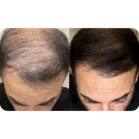 مو و بازی