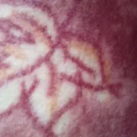 موکت طرح دار