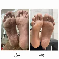 پدیکور و کف سابی پا|خدمات آرایشگری و زیبایی|اصفهان, خرم|دیوار