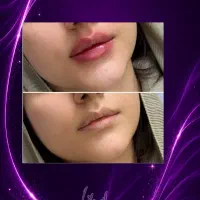 دکتر کامبیز محمدپور«ایرانا»گلدلاک روسی عروسکی۲/۹۹۰