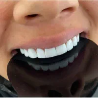 دندانپرشکی رز کامپوزیت روکش لمینت دندان|خدمات آرایشگری و زیبایی|قرچک, شهرک طلائیه|دیوار