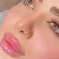 تزریق ژل و بوتاکس