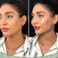 مدل فیلراروپایی