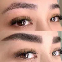 فیبروزکرکی مویی