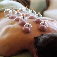 بادکش سرد بادکش گرم سنگداغ