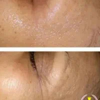 مراقبتی و ارایشی