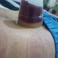 قدرت ایمنی بدن خودرابالاببرید هیچوقت دکترنرید