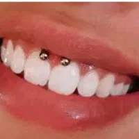 فروش واجرای پرسینگ وآموزش