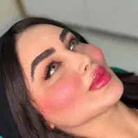 تخفیف ژل ‌‌لب بوتاکس جوانساز در کلینیک