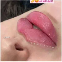 بوتاکس رایگان|خدمات آرایشگری و زیبایی|قم, زنبیل آباد|دیوار