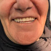 خدمات دندانسازی مروارید|خدمات آرایشگری و زیبایی|دهدشت, |دیوار