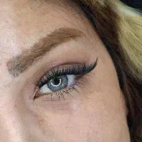 تخفیف کاشت موقت(هیدن)