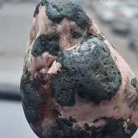 سنگ کلکسیونی