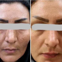 معجزه با اکسیر های سلامتی|خدمات آرایشگری و زیبایی|چناران, |دیوار