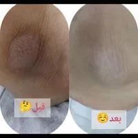 پدیکوریست خاص/ترک/پینه/قوزک|خدمات آرایشگری و زیبایی|قم, سالاریه|دیوار