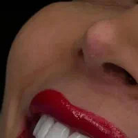 کامپوزیت دندان،روکش،لمینت،اموزش کامپوزیت|خدمات آرایشگری و زیبایی|فردیس, فردیس|دیوار