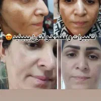 کرم معجزه شب|آرایشی، بهداشتی، درمانی|بندر گز, |دیوار