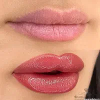 جذب مدل محدود برای آرایش دائم