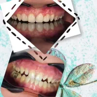 ارائه کلیه خدمات دندانپزشکی
