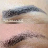 ریموو سخت ترین تتو های قدیمی تضمینی