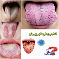 ریشه یابی بیماریها