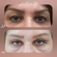 تخفیف ویژه عمل های جراحی زیبایی(30درصد off)