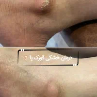 خدمات ناخن و کفسابی پا|خدمات آرایشگری و زیبایی|اصفهان, جلالیه|دیوار