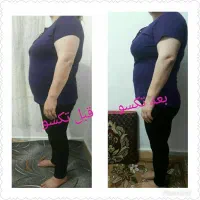 چربی سوزی ولاغری وزیبایی صورت|آرایشی، بهداشتی، درمانی|ایلام, |دیوار