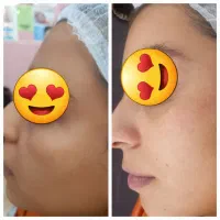 فشیال و خدمات جوانسازی ارغوان فقط دویست هزار تومان|خدمات آرایشگری و زیبایی|نیشابور, دارایی|دیوار