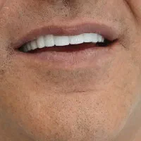 کلینیک تخصصی ایمپلنت با اقساط بلندمدت|خدمات آرایشگری و زیبایی|تهران, قیطریه|دیوار