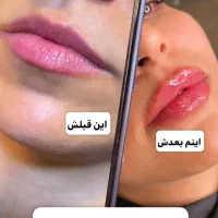 بلفاروپلاستی، پاک کردن تتو، ژل لب، وایتنینگ پوست|خدمات آرایشگری و زیبایی|باقرشهر, |دیوار