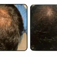 اعتماد به نفس دوباره