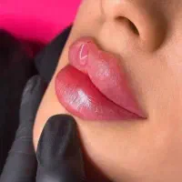 آموزش ژل و بوتاکس همراه استخدام در کلینیک