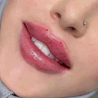 فیلر بوتاکس لیزر موهای زائد فیشال فشیال|خدمات آرایشگری و زیبایی|تهران, سبلان (لشگر)|دیوار