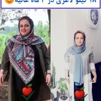 اضافه وزن وپوست آسیب دیده از شما ولاغری از ما|آرایشی، بهداشتی، درمانی|گلپایگان, |دیوار