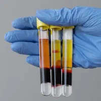 50درصد تخفیف اولین جلسه prp