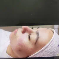 پاکسازی تخصصی پوست|خدمات آرایشگری و زیبایی|خوی, |دیوار