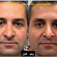 جراحی صورت ۵۰درصد تخفیف|خدمات آرایشگری و زیبایی|تهران, دروس|دیوار